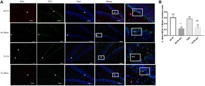 Sevoflurane-Induced Neuroapoptosis in Rat Dentate Gyrus Is Activated by Autophagy Through NF-κB Signaling on the Late-Stage Progenitor Granule Cells